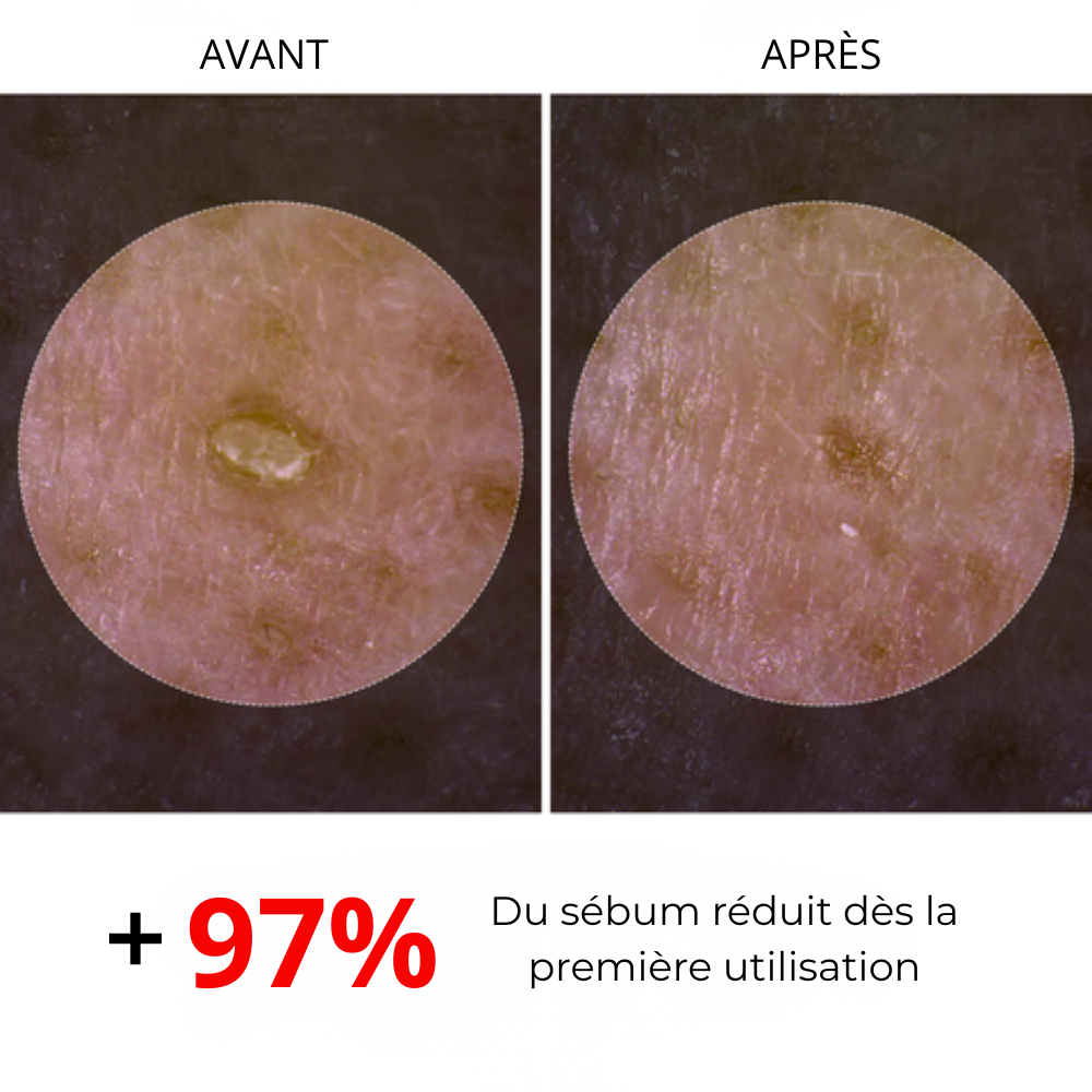 Ivory Paris - RiceSérum | N'ayez plus honte de votre peau